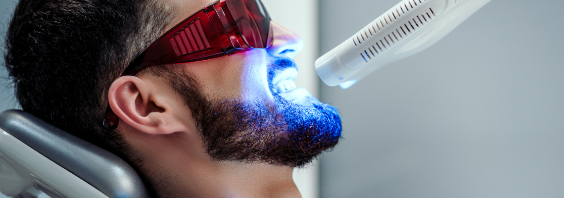 Laser teeth whitening