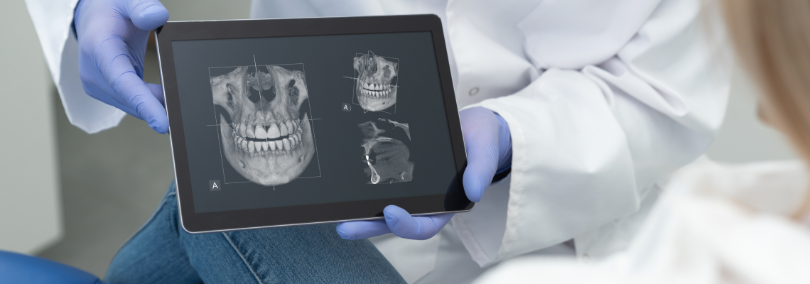 3D skaitmeninė rentgenografija