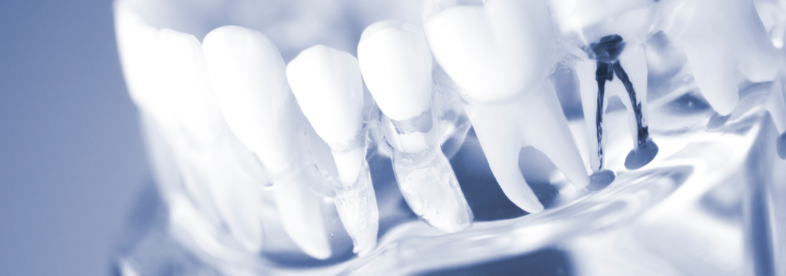 Dental root canal treatment